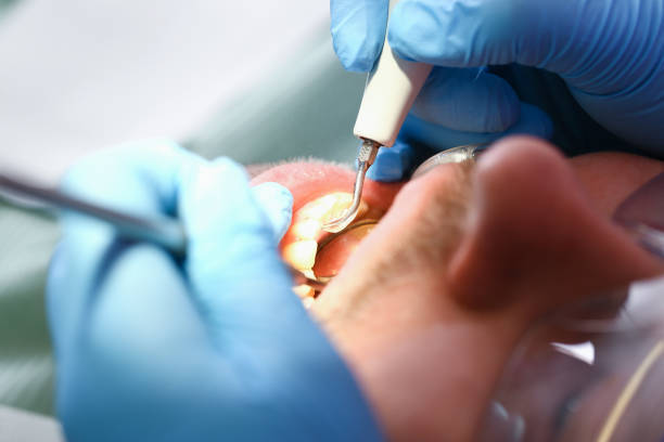 Best Dentist for Tooth Abscess  in Everett, MA
